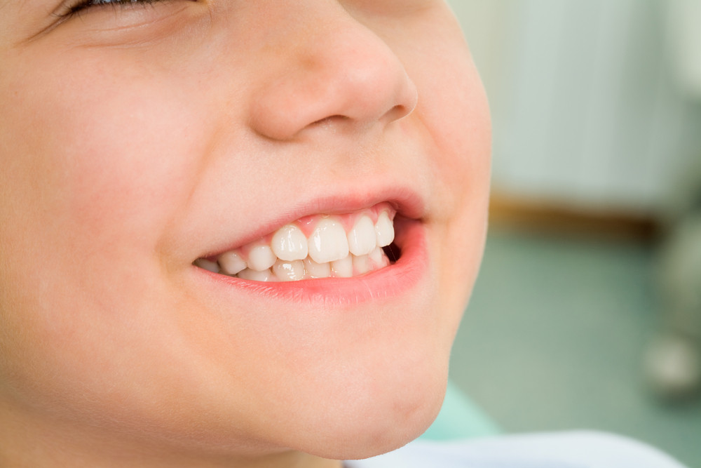 5 Things You Should Know About Oral Health for Kids